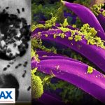 Doctor warns of Russian response to possible plague outbreak | Wake Up America Weekend