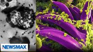 Doctor warns of Russian response to possible plague outbreak | Wake Up America Weekend